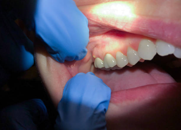Best Broken or Cracked Tooth Emergency Dentist in Churchill, OH