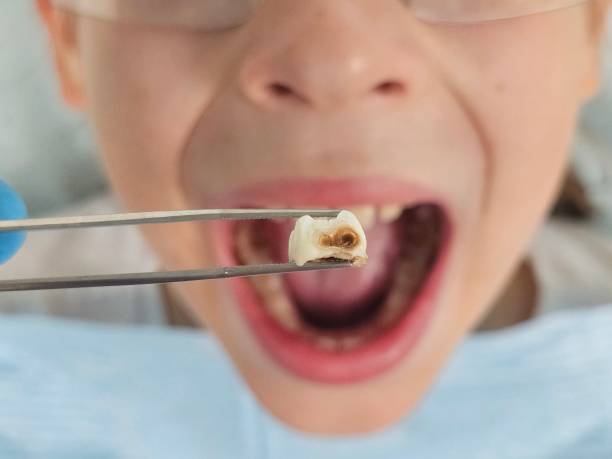 Best Pediatric Emergency Dentist in Churchill, OH